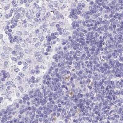 Immunohistochemistry-Paraffin: VIAAT/SLC32A1/VGAT Antibody [NBP2-34131]
