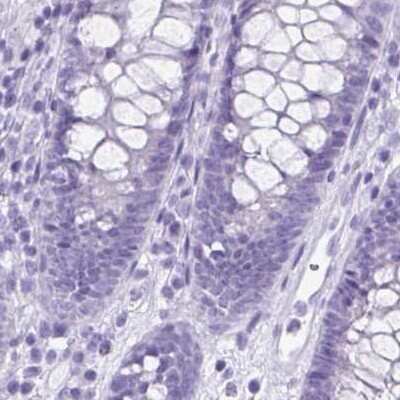 Immunohistochemistry-Paraffin: VIAAT/SLC32A1/VGAT Antibody [NBP2-34131]