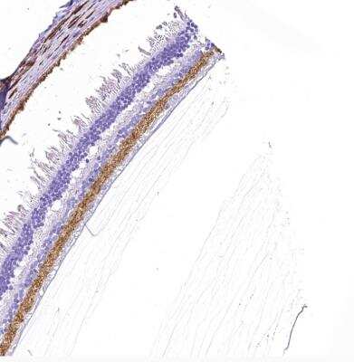 Immunohistochemistry-Paraffin: VIAAT/SLC32A1/VGAT Antibody [NBP2-34131]