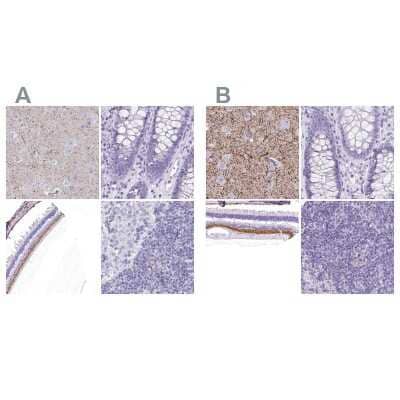 Immunohistochemistry-Paraffin: VIAAT/SLC32A1/VGAT Antibody [NBP2-34131]