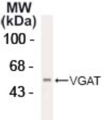 Western Blot: VIAAT/SLC32A1/VGAT Antibody [NB300-740]