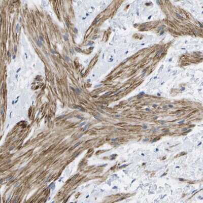 Immunohistochemistry-Paraffin: VIGR/GPR126 Antibody [NBP1-89859]