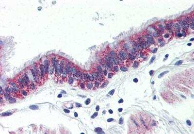 Immunohistochemistry-Paraffin: VIGR/GPR126 Antibody - BSA Free [NBP3-06680]