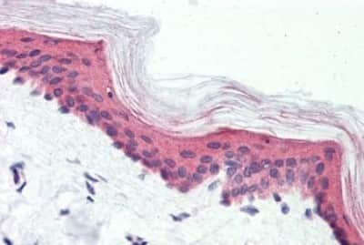 Immunohistochemistry-Paraffin: VIGR/GPR126 Antibody [NBP3-14378]