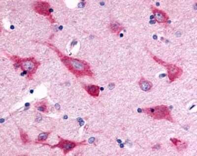 Immunohistochemistry-Paraffin: VIGR/GPR126 Antibody - BSA Free [NLS1720]