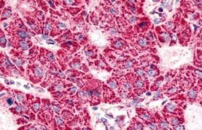 Immunohistochemistry-Paraffin: VIGR/GPR126 Antibody - BSA Free [NLS1720]