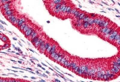 Immunohistochemistry-Paraffin: VIGR/GPR126 Antibody - BSA Free [NLS1720]