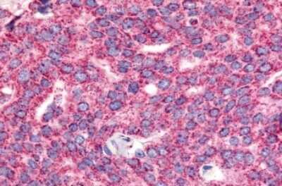 Immunohistochemistry-Paraffin: VIGR/GPR126 Antibody - BSA Free [NLS1720]