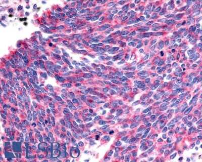Immunohistochemistry-Paraffin: VIGR/GPR126 Antibody - BSA Free [NLS1720]