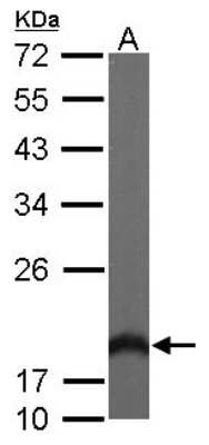 Western Blot: VILIP3 Antibody [NBP2-14988]