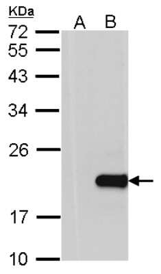 Western Blot: VILIP3 Antibody [NBP2-14988]