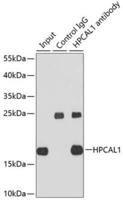 Western Blot: VILIP3 AntibodyBSA Free [NBP2-95122]