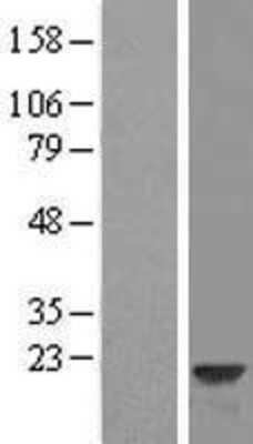 Western Blot: VILIP3 Overexpression Lysate [NBL1-11688]