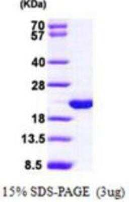 SDS-PAGE: Recombinant Human VILIP3 His Protein [NBP1-48588]