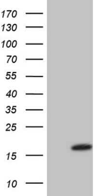 Western Blot: VIP Antibody (OTI1E8) [NBP2-46349]