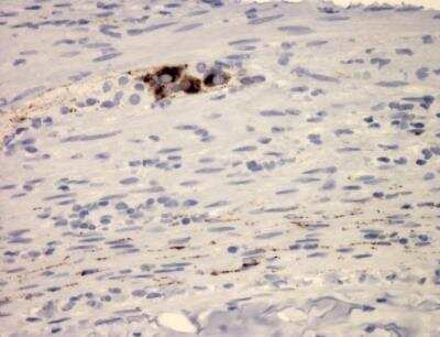 Immunohistochemistry-Paraffin: VIP Antibody (2) - BSA Free [NBP1-05163]