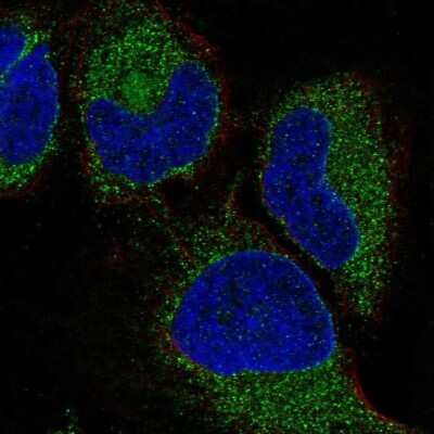 Immunocytochemistry/ Immunofluorescence: VIP Antibody [NBP2-57264]