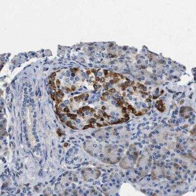 Immunohistochemistry-Paraffin: VIP Antibody [NBP1-86446]