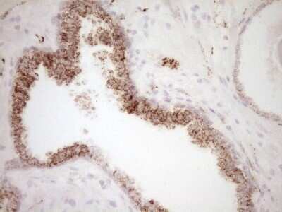 Immunohistochemistry: VIP Antibody (OTI1E8) - Azide and BSA Free [NBP2-74848]