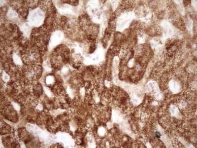 Immunohistochemistry: VIP Antibody (OTI1E8) - Azide and BSA Free [NBP2-74848]