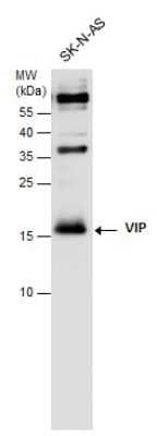 Western Blot: VIP Antibody [NBP3-12899]