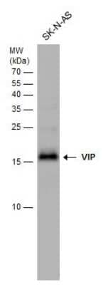 Western Blot: VIP Antibody [NBP3-12900]