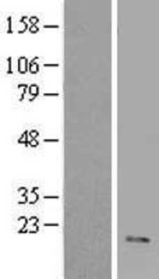 Western Blot: VIP Overexpression Lysate [NBL1-17722]