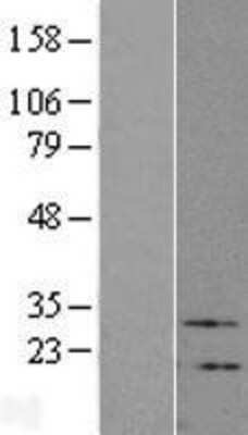 Western Blot: VIP Overexpression Lysate [NBL1-17723]