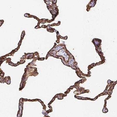 Immunohistochemistry-Paraffin: VIPR2/VPAC2 Antibody [NBP2-34149]