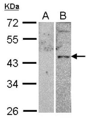 Western Blot: VIPR2/VPAC2 Antibody [NBP2-20867]