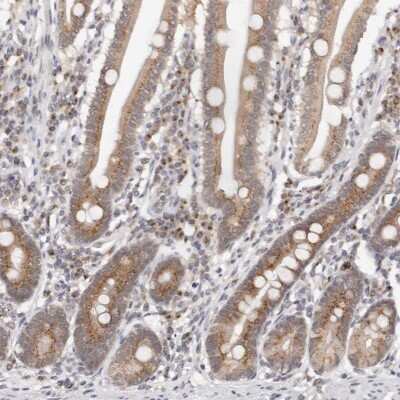 Immunohistochemistry-Paraffin: VIPAR Antibody [NBP1-89901]