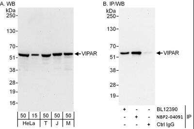 Immunoprecipitation: VIPAR Antibody [NBP2-04091]