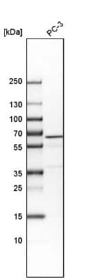 Western Blot: VIPAR Antibody [NBP1-89901]