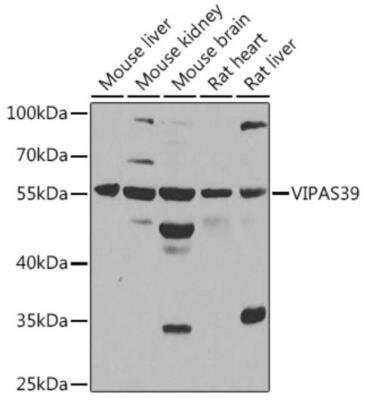 Western Blot: VIPAR AntibodyBSA Free [NBP2-94018]