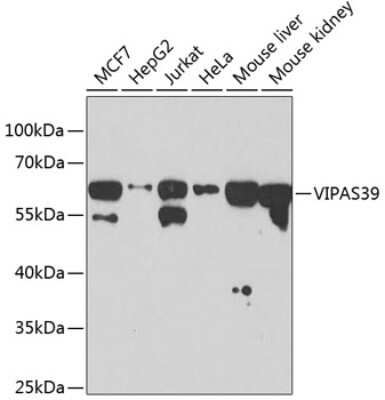 Western Blot: VIPAR AntibodyBSA Free [NBP2-94308]