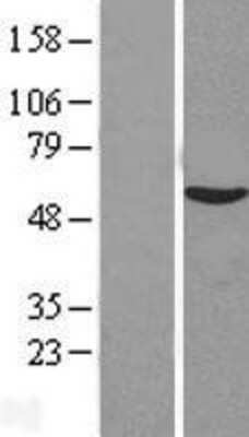 Western Blot: VIPAR Overexpression Lysate [NBL1-08175]