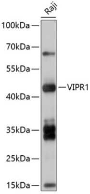 Western Blot: VIPR1/VPAC1 AntibodyBSA Free [NBP2-94168]