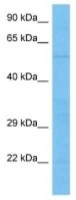 Western Blot: VIPR1/VPAC1 Antibody [NBP3-10042]