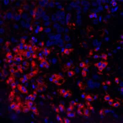 Immunocytochemistry/ Immunofluorescence: VISTA/B7-H5/PD-1H Antibody (BLR035F) [NBP2-76406]