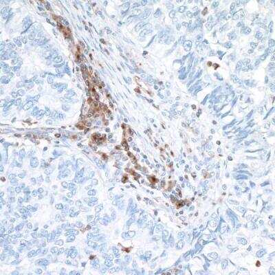 Immunohistochemistry-Paraffin: VISTA/B7-H5/PD-1H Antibody (BLR035F) [NBP2-76406]