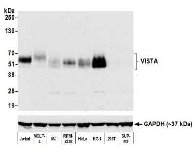 Western Blot: VISTA/B7-H5/PD-1H Antibody (BLR035F) [NBP2-76406]