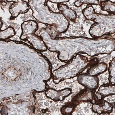 Immunohistochemistry-Paraffin: VISTA/B7-H5/PD-1H Antibody (CL3975) [NBP2-59030]