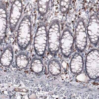 Immunohistochemistry-Paraffin: VISTA/B7-H5/PD-1H Antibody (CL3975) [NBP2-59030]