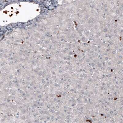 Immunohistochemistry-Paraffin: VISTA/B7-H5/PD-1H Antibody (CL3975) [NBP2-59030]