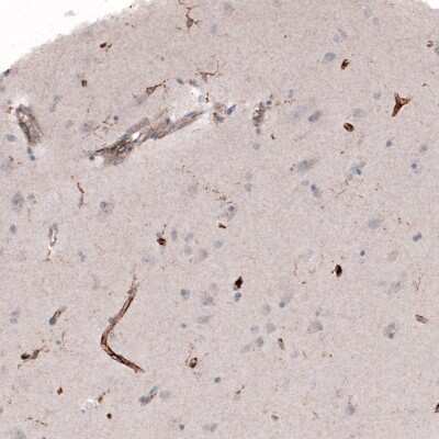 Immunohistochemistry-Paraffin: VISTA/B7-H5/PD-1H Antibody (CL3975) [NBP2-59030]