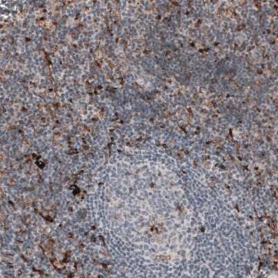 Immunohistochemistry-Paraffin: VISTA/B7-H5/PD-1H Antibody (CL3975) [NBP2-59030]