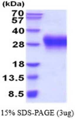 SDS-PAGE: Recombinant Human VISTA/B7-H5/PD-1H His Protein [NBP2-52255]