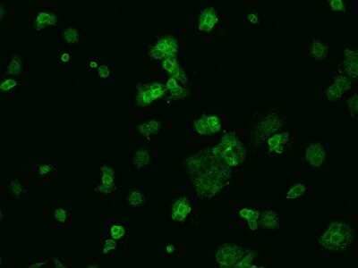 Immunocytochemistry/ Immunofluorescence: VKORC1 Antibody [NBP2-97577]