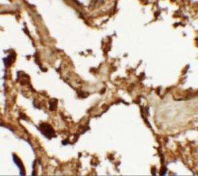 Immunohistochemistry: VKORC1 Antibody - BSA Free [NBP2-81859]