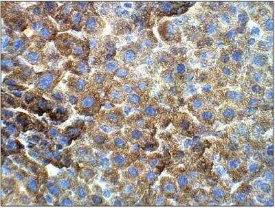 Immunohistochemistry-Paraffin: VKORC1 Antibody [NBP3-12232]